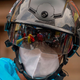 Image for article titled Take the Reports of Covid-19 Reinfection With a Grain of Salt